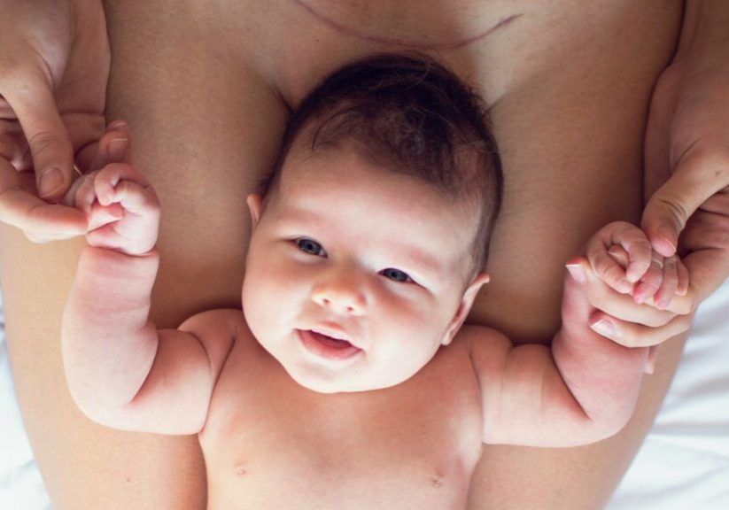baby resting in mother's lap below C-section scar